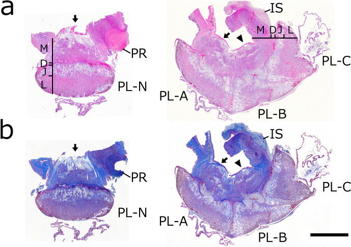 Histopathology of fused triplet placenta in rat.