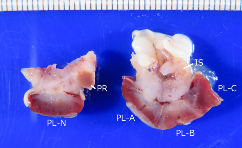 Histopathology of fused triplet placenta in rat.