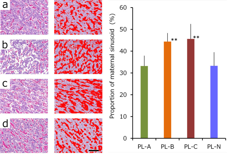 Histopathology of fused triplet placenta in rat.