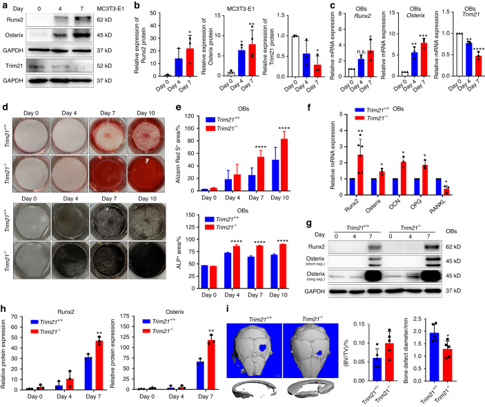 Trim21 depletion alleviates bone loss in osteoporosis via activation of YAP1/β-catenin signaling.