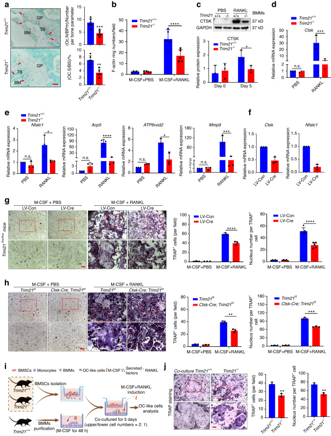 Trim21 depletion alleviates bone loss in osteoporosis via activation of YAP1/β-catenin signaling.