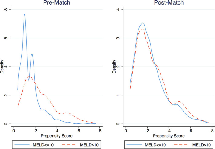 MELD score predicts short-term outcomes after surgical management of proximal humerus fractures: a matched analysis.