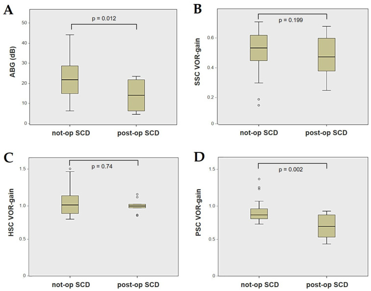 Impaired Vestibulo-Ocular Reflex on Video Head Impulse Test in Superior Canal Dehiscence: "Spontaneous Plugging" or Endolymphatic Flow Dissipation?