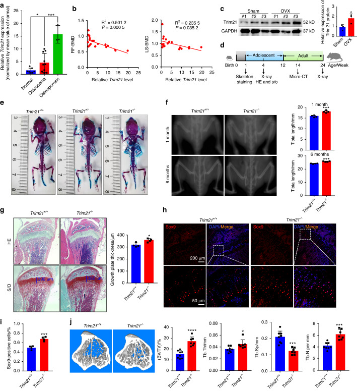 Trim21 depletion alleviates bone loss in osteoporosis via activation of YAP1/β-catenin signaling.