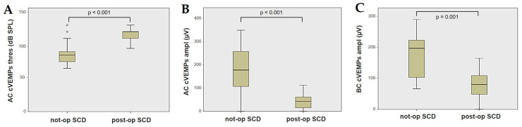 Impaired Vestibulo-Ocular Reflex on Video Head Impulse Test in Superior Canal Dehiscence: "Spontaneous Plugging" or Endolymphatic Flow Dissipation?