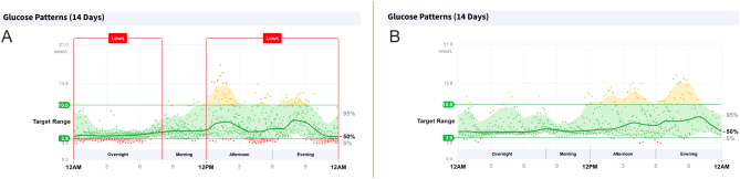 Post-bariatric hypoglycaemia diagnosed during pregnancy.