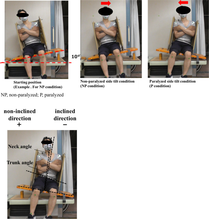 Effects of Task-related Trunk Training with Sensory Electrical Stimulation on Sitting Balance in Stroke Survivors: A Randomized Controlled Trial.