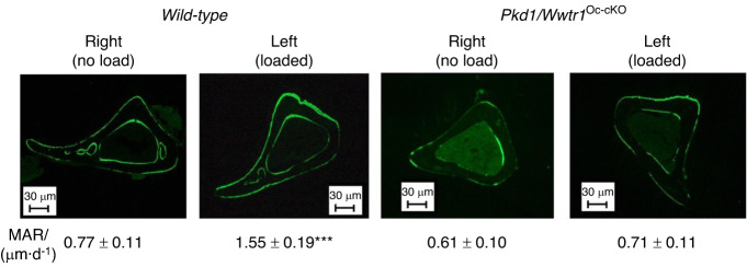 Genetic interactions between polycystin-1 and Wwtr1 in osteoblasts define a novel mechanosensing mechanism regulating bone formation in mice.