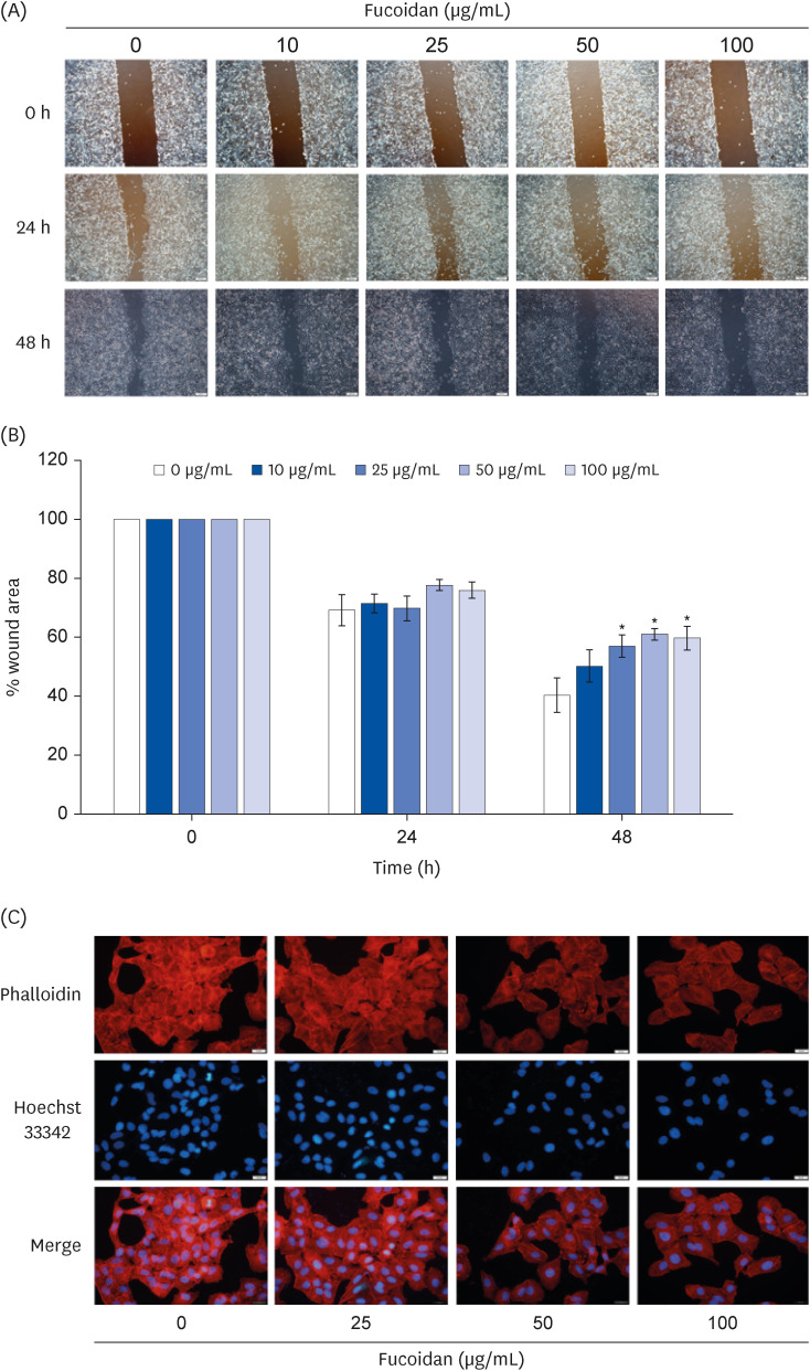 Antimetastatic effect of fucoidan against non-small cell lung cancer by suppressing non-receptor tyrosine kinase and extracellular signal-related kinase pathway.