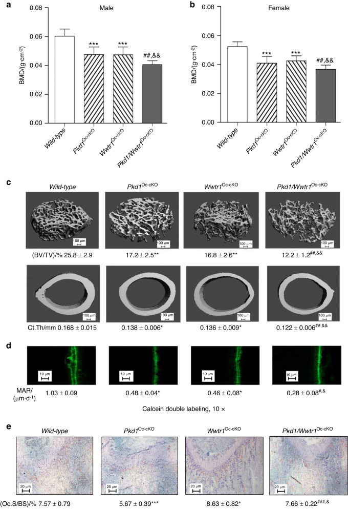 Genetic interactions between polycystin-1 and Wwtr1 in osteoblasts define a novel mechanosensing mechanism regulating bone formation in mice.