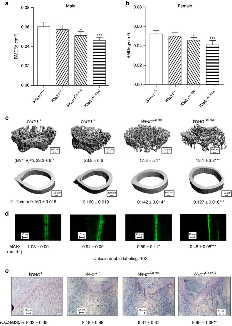 Genetic interactions between polycystin-1 and Wwtr1 in osteoblasts define a novel mechanosensing mechanism regulating bone formation in mice.