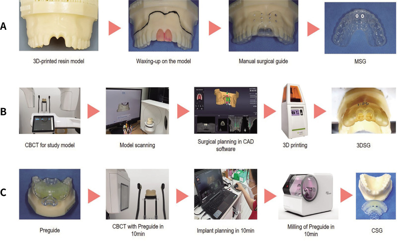 Reliability of a chairside CAD-CAM surgical guide for dental implant surgery on the anterior maxilla: An <i>in vitro</i> study.