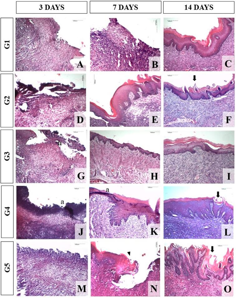 Evaluation of the effect of Matricaria recutita monotherapy or in combination with photodynamic therapy on tissue repair in the dorsum of the tongue of rats.