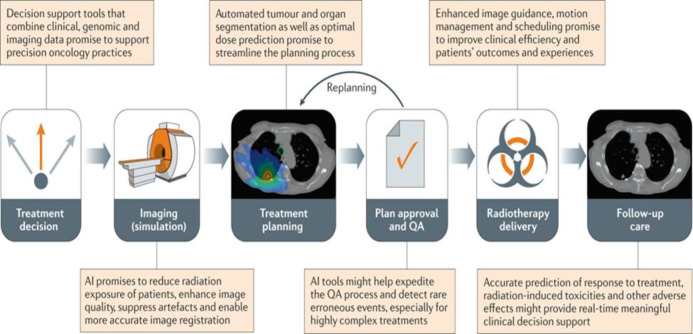 The influence of artificial intelligence on the work of the medical physicist in radiotherapy practice: a short review.