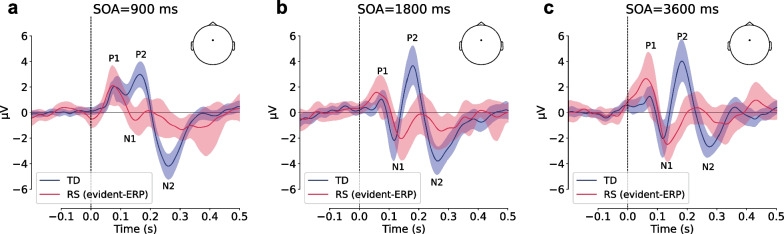 Effect of presentation rate on auditory processing in Rett syndrome: event-related potential study.