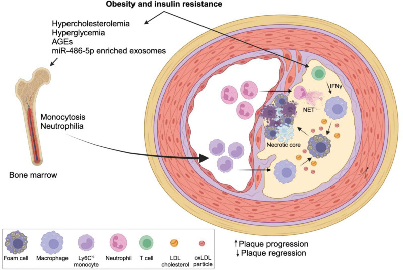 Macrophage immunometabolism in diabetes-associated atherosclerosis.