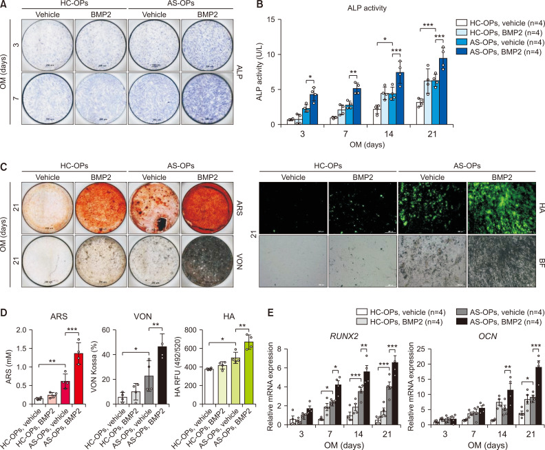 Elevated BMPR2 expression amplifies osteoblast differentiation in ankylosing spondylitis.