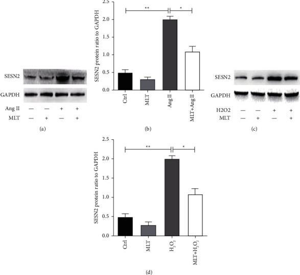 Melatonin Ameliorates Ovarian Hyperstimulation Syndrome (OHSS) through SESN2 Regulated Antiapoptosis.