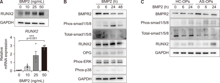 Elevated BMPR2 expression amplifies osteoblast differentiation in ankylosing spondylitis.