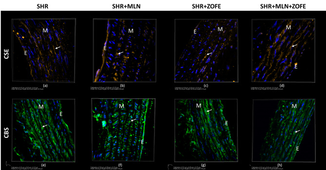 The effect of zofenopril on the cardiovascular system of spontaneously hypertensive rats treated with the ACE2 inhibitor MLN-4760.