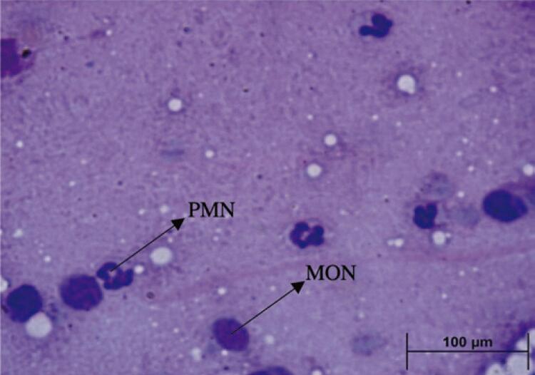 Articular mobilization promotes improvement in functional and inflammatory parameters in a gouty arthritis model.