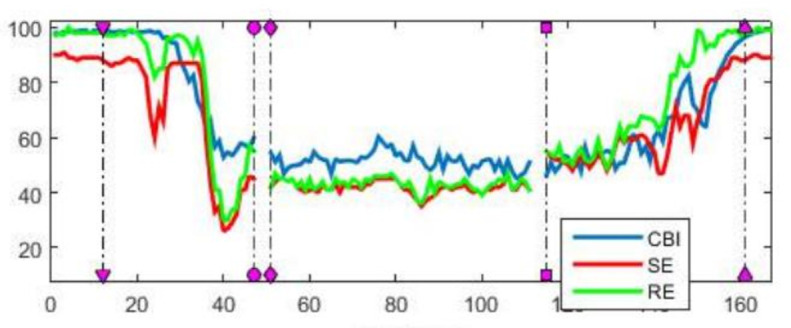 Signal processing and machine learning algorithm to classify anaesthesia depth.