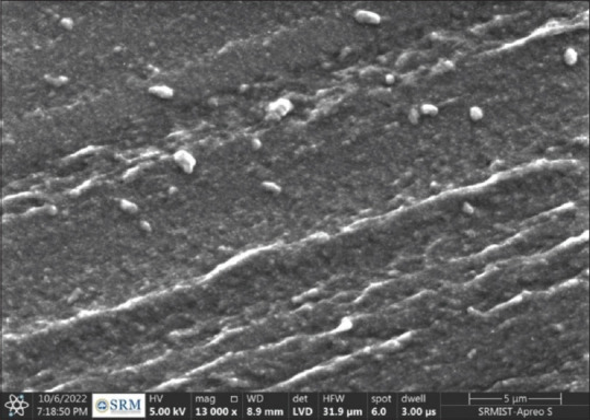 Effect of different concentrations of titanium and silver nanoparticles on maxillofacial silicone MDX4-4210 on cell viability, tear bond strength, and shore strength: An <i>in vitro</i> study.