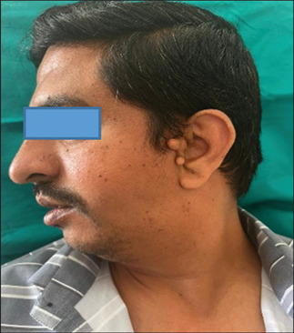 Diagnostic Imageology of Goldenhar Syndrome: Report of a Rare Case.