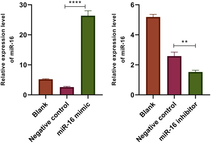 The Role and Antagonistic Effects of miR-16-5p in the Regulation of ADP-Ribosylation Factor-Like Tumor Suppressor Gene 1 in Lung Cancer Cells.