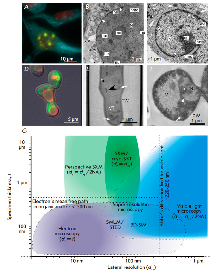 Soft X-ray Microscopy in Cell Biology: Current Status, Contributions and Prospects.