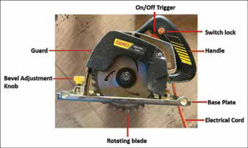 A retrospective observational study of injury patterns associated with powered circular saw in subjects presenting to the emergency department of a tertiary care hospital.