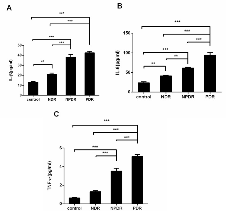 Downregulation of SIRT6 and NMNAT2 is associated with proliferative diabetic retinopathy.