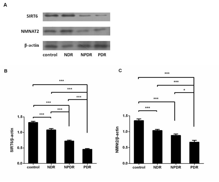 Downregulation of SIRT6 and NMNAT2 is associated with proliferative diabetic retinopathy.