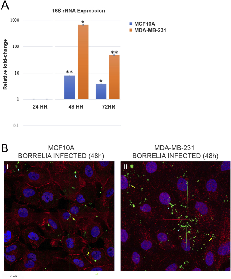 Global transcriptomic analysis of breast cancer and normal mammary epithelial cells infected with Borrelia burgdorferi.