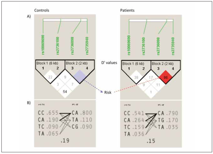 Two co-inherited SNPs of the telomerase reverse transcriptase (TERT) gene are associated with Iraqi patients with lung cancer.
