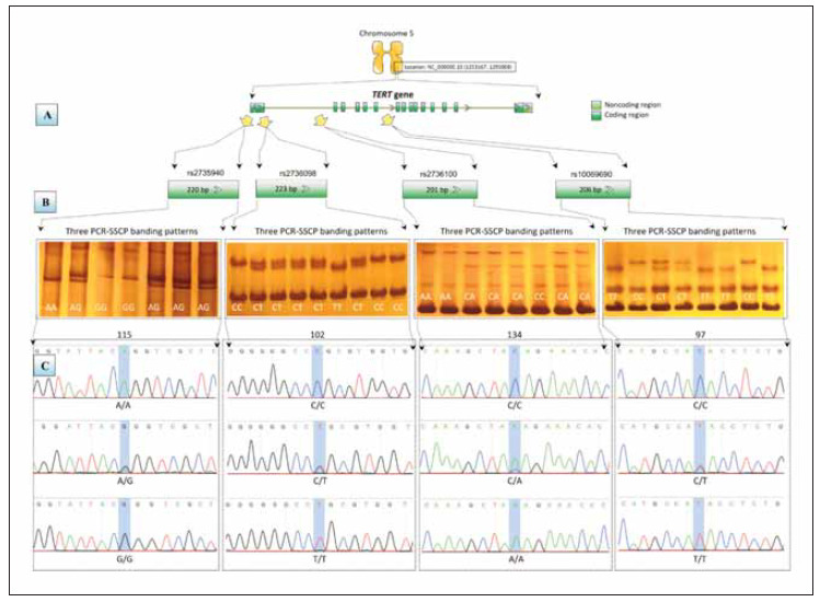 Two co-inherited SNPs of the telomerase reverse transcriptase (TERT) gene are associated with Iraqi patients with lung cancer.