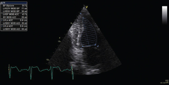 Can Global Longitudinal Strain Assess Asymptomatic Subtle Left Ventricular Dysfunction in Recovered COVID-19 Patients?