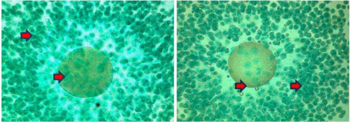 The Impact of Endometriosis on Intracellular Calcium Levels, Cyclic Dependent Kinase 1 (Cdk1) Expression, and Cyclin B Expression in Post-Ovulation Oocytes of Mice Model.
