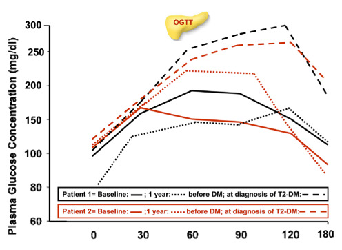 The effects of excess weight on glucose homeostasis in young adult females with β-thalassemia major (β-TM): a preliminary retrospective study.