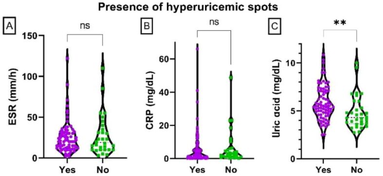 Time to redefine hyperuricemia? The serum uric acid cut-off level for precipitation might be lower: a pilot study.