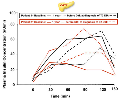 The effects of excess weight on glucose homeostasis in young adult females with β-thalassemia major (β-TM): a preliminary retrospective study.