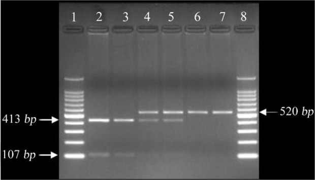The Effect of FSHR (G2039A) Polymorphism on Müllerian Duct Development and Hormonal Profile of Women with Primary Amenorrhea.