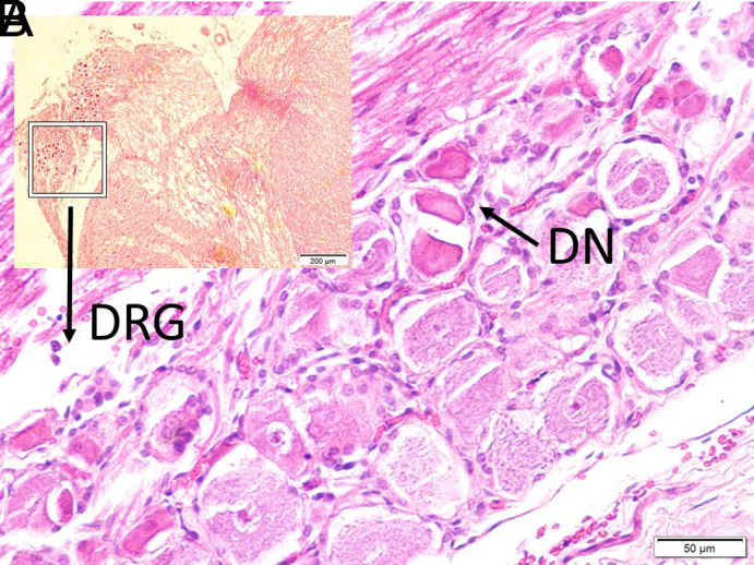 Changes in the Urethral Artery After Experimental Subarachnoid Hemorrhage-Induced Injury of the Pudendal Ganglion and Onuf's Nucleus Junction.