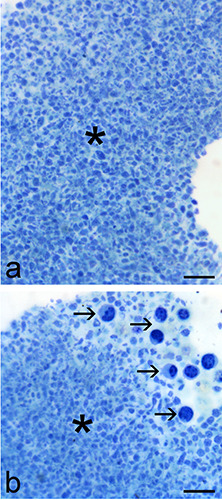 Ozone and procaine increase secretion of platelet-derived factors in platelet-rich plasma.