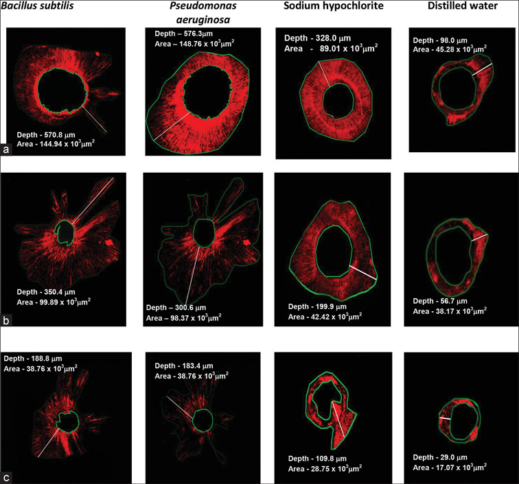 Development of Efficacious and Less Toxic Endodontic Irrigants from Biosurfactants of Bacterial Origin - A Confocal Laser Scanning Microscope Study.