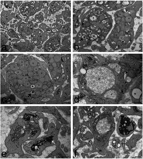 Ozone and procaine increase secretion of platelet-derived factors in platelet-rich plasma.