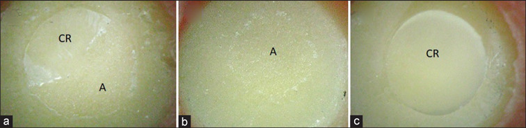 Are Universal Adhesives Effective for Bonding to Zirconia in the Long Term?