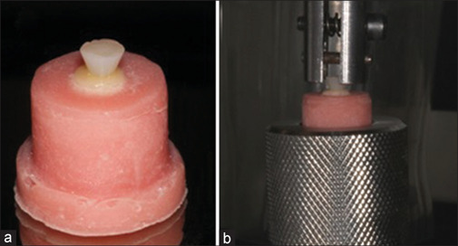 Are Universal Adhesives Effective for Bonding to Zirconia in the Long Term?