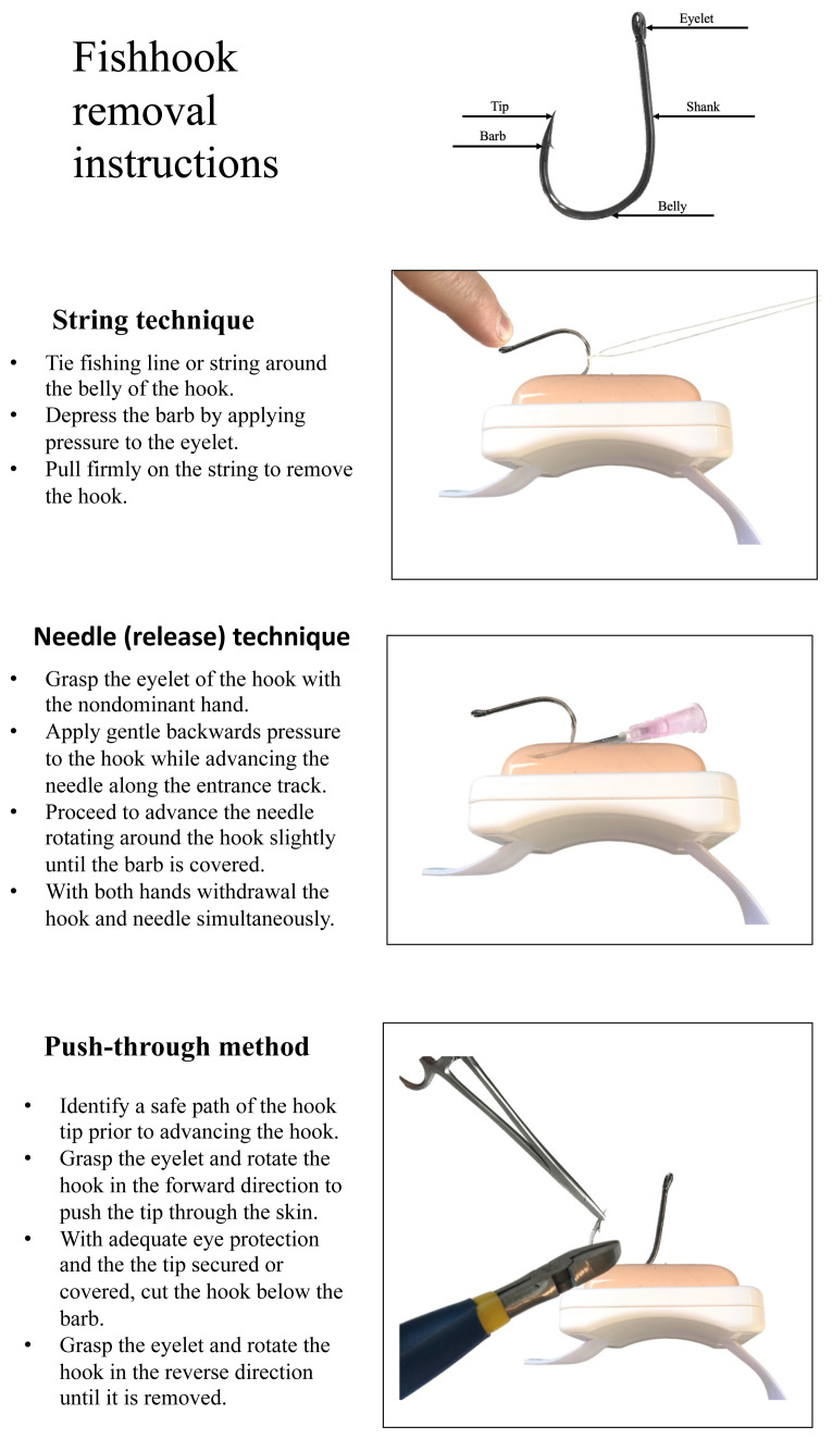 Low-Cost Fishhook Removal Simulation.