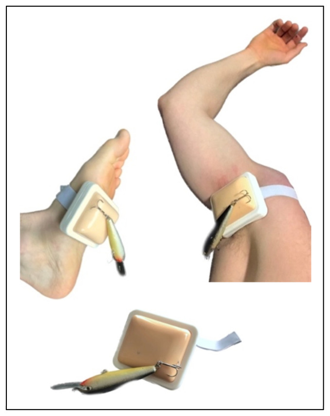 Low-Cost Fishhook Removal Simulation.